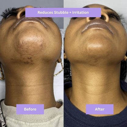 AYNURA - Cyperus Rotundus Skin Serum - New Design