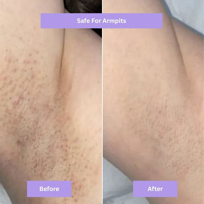 AYNURA - Cyperus Rotundus Skin Serum - New Design