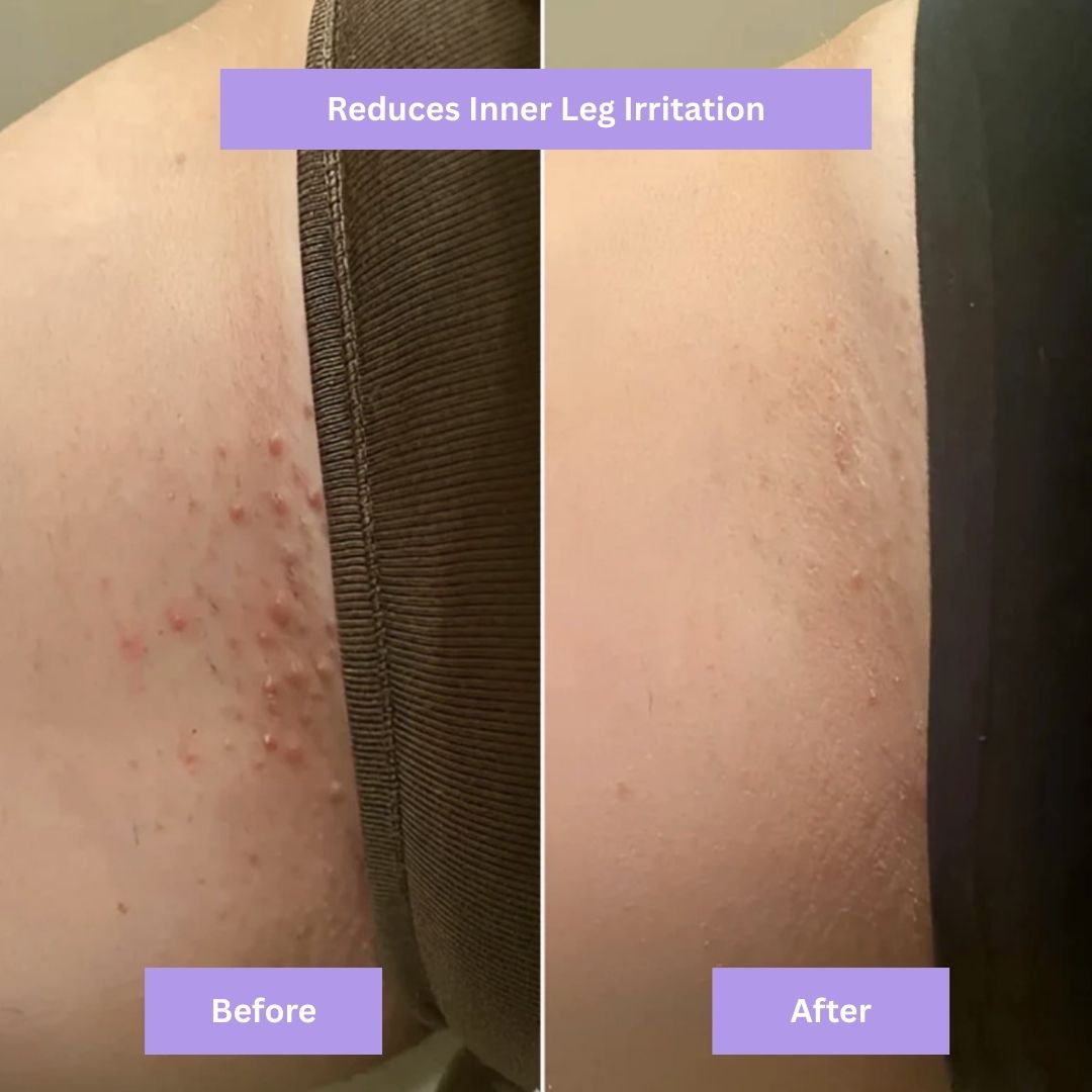 AYNURA - Cyperus Rotundus Skin Serum - New Design