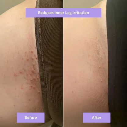 AYNURA - Cyperus Rotundus Skin Serum - New Design